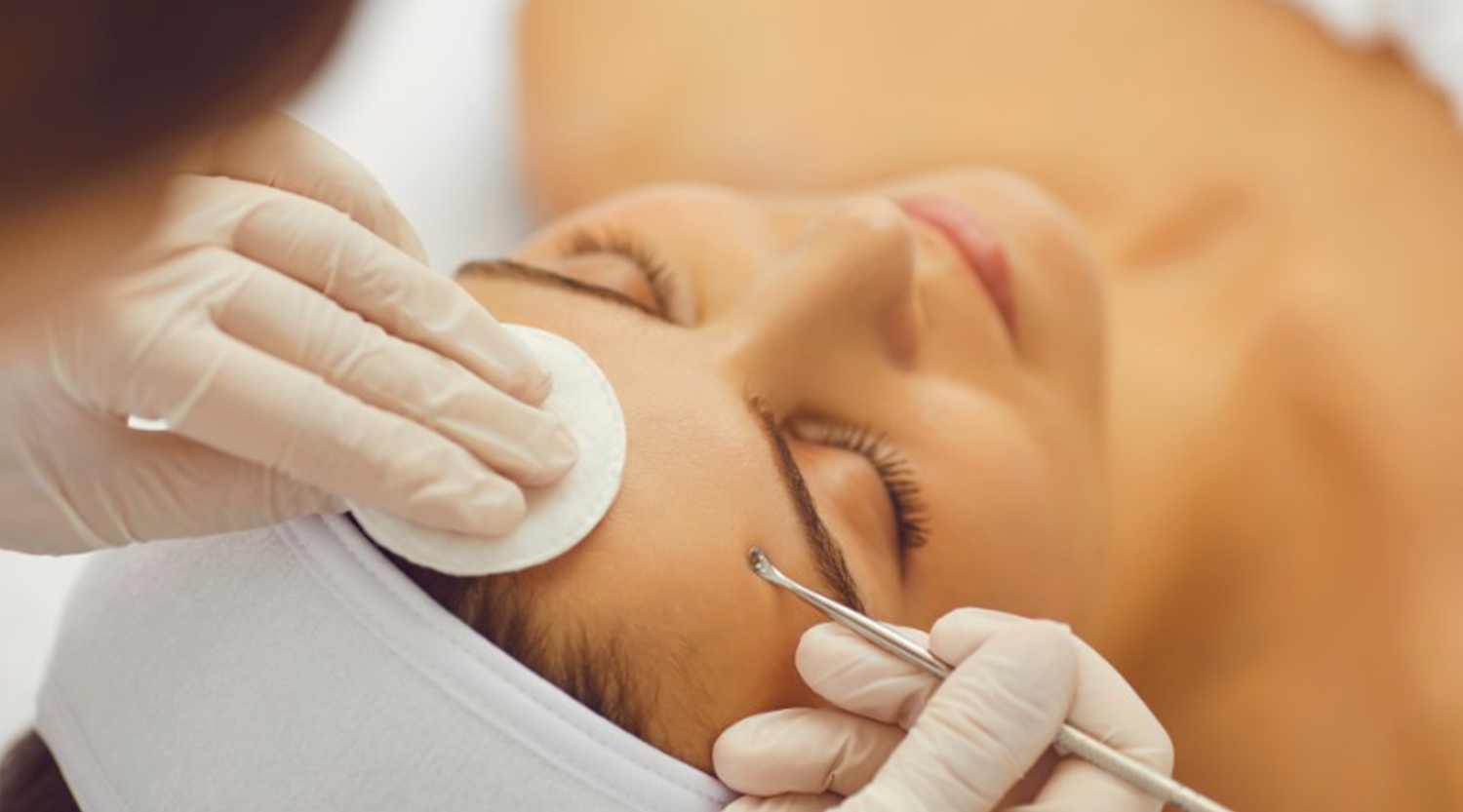 how to stop stress acne