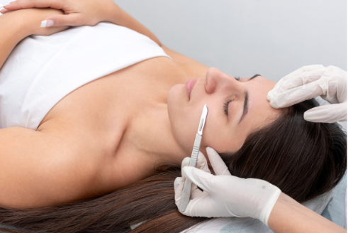 A skincare professional performing dermaplaning treatment on a woman’s face to remove dead skin cells, revealing a smoother, more radiant complexion. This procedure helps improve skin texture and promotes healthier skin appearance.