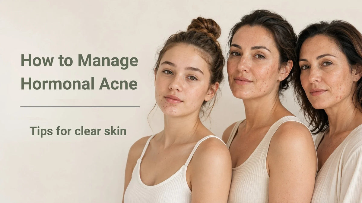 How to Manage Hormonal Acne: Tips for Different Ages