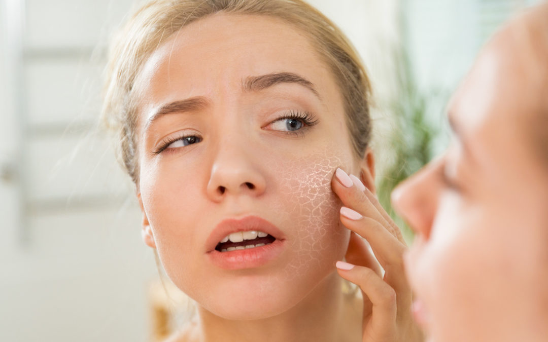 Your Skin Doesn’t Need to Be Perfect to be Beautiful