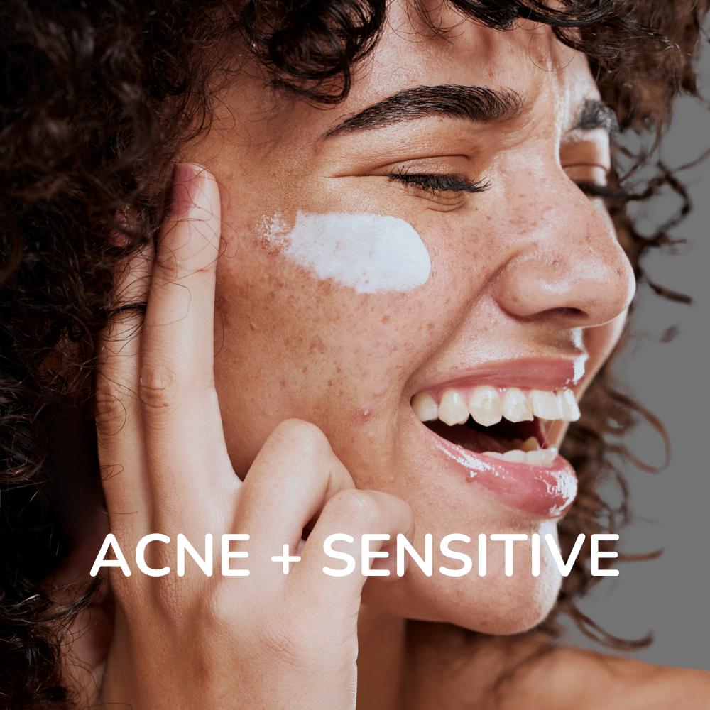 face with cream. acne prone