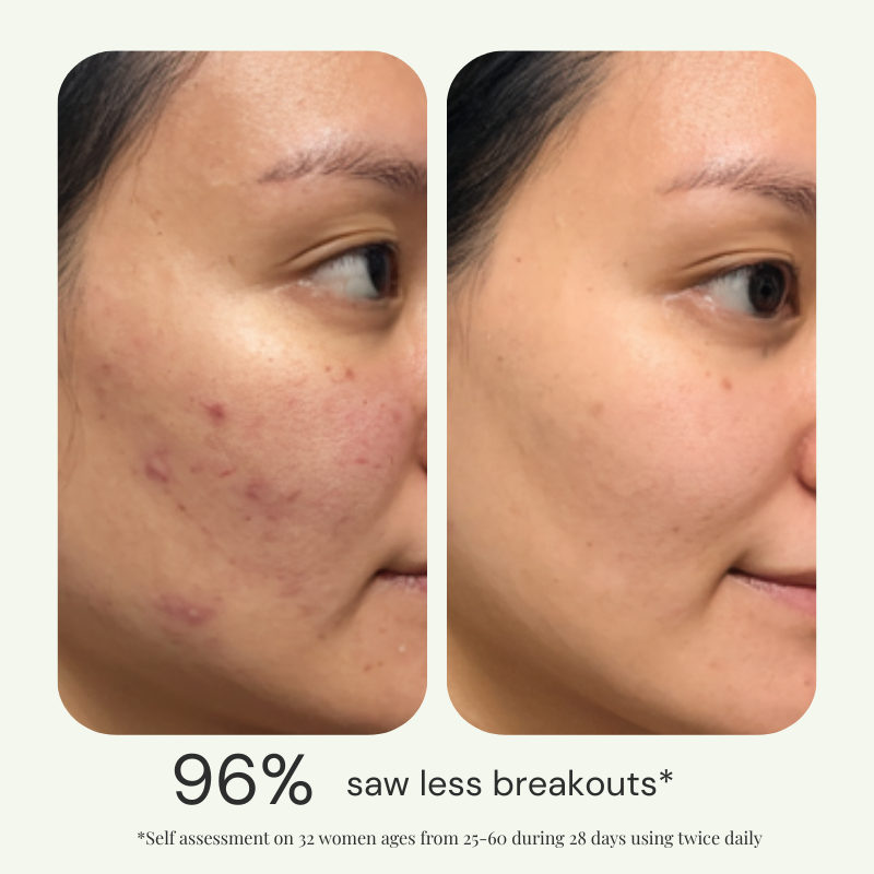 Perfect 10 Serum
