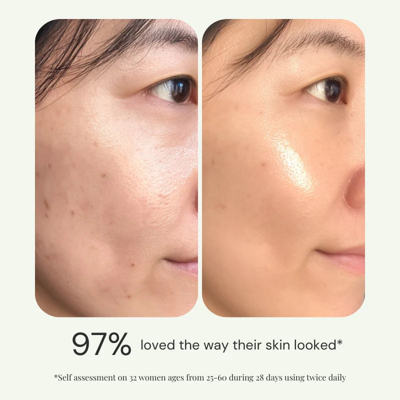 Clear Skin Kit