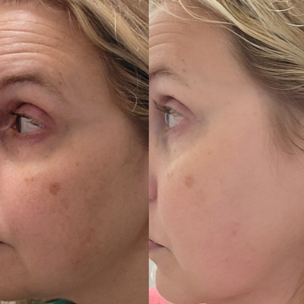 I'm 62 and after 60 days, my skin is much brighter, smoother and I love how it looks and feel.