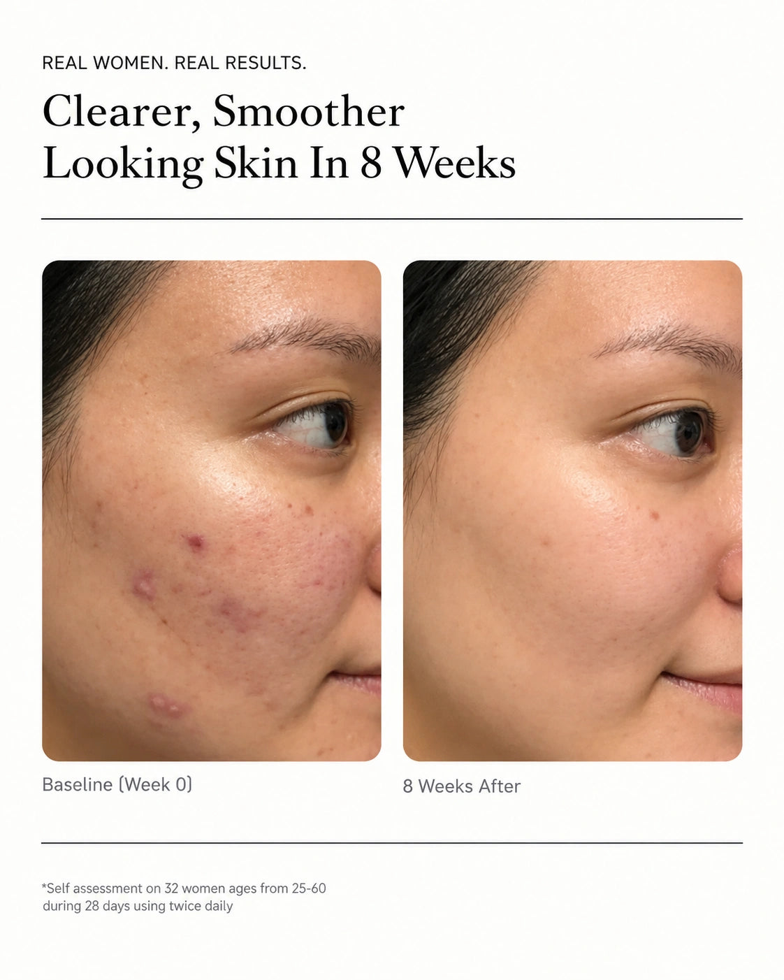 Clear Skin Kit