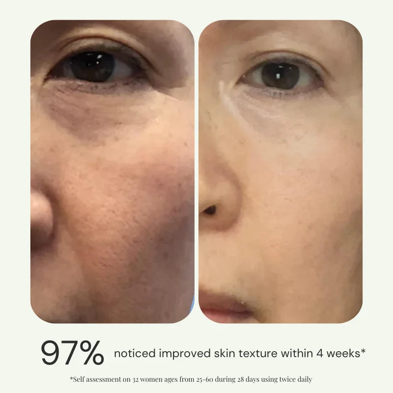 Perfect Skin Kit