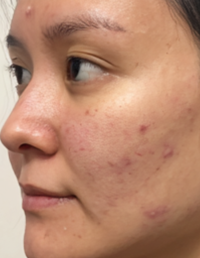 Before – Perfect 10 Serum